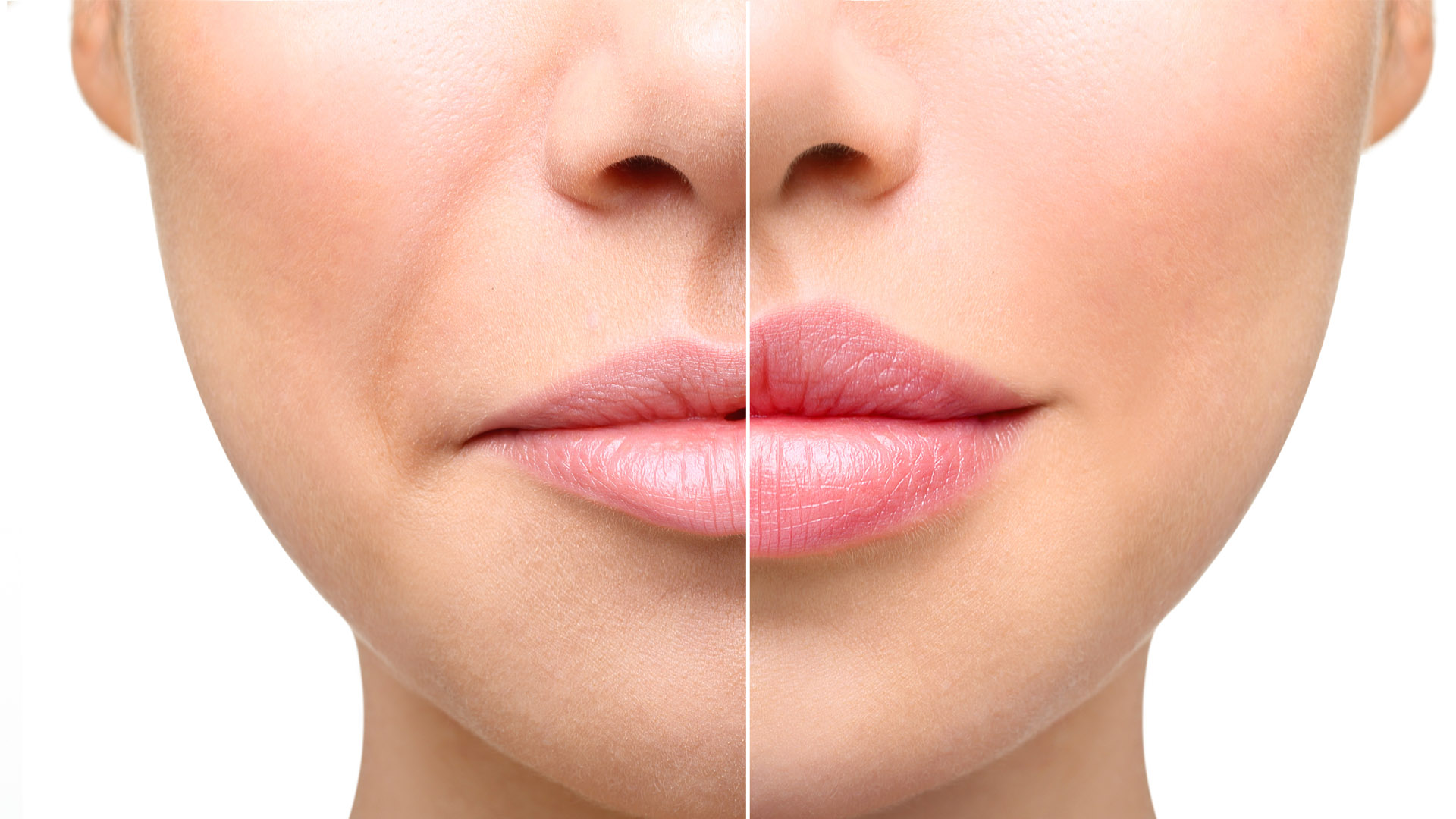 Why Aesthetic Lab Offers the Best Lip Fillers in Houston