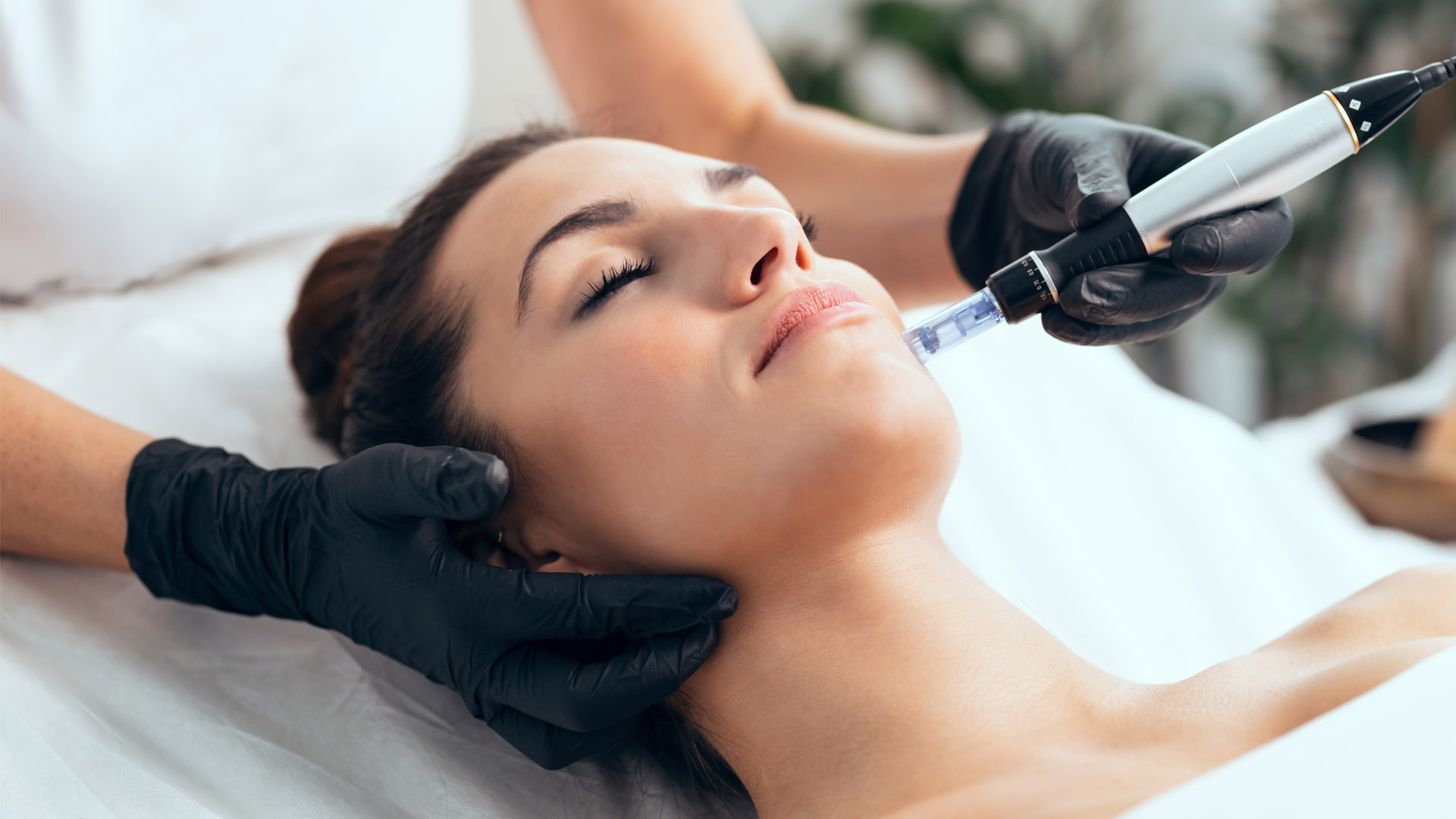 The Guide to Microneedling at Houston’s Best Med Spa