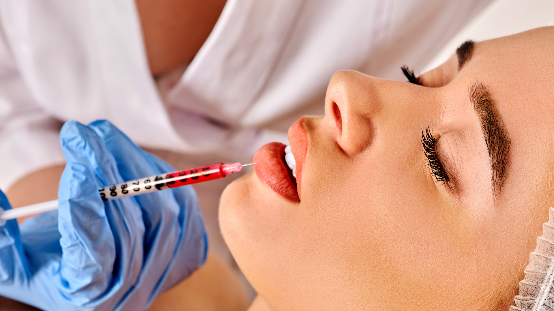 Dermal Fillers in Houston